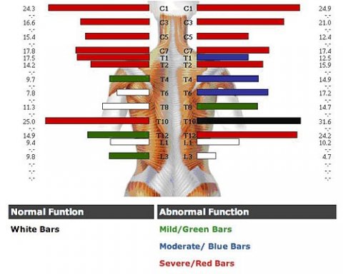 NeuroSpinal Functional Index - Chiropractic Plus